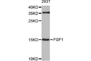 Western blot analysis of extracts of 293T cells, using FGF1 antibody. (FGF1 antibody)