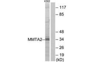 Western blot analysis of extracts from K562 cells, using MMTAG2 Antibody. (C1orf35 antibody  (AA 10-59))