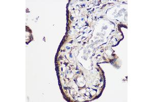 Immunohistochemistry of paraffin-embedded Human placenta using LRRK2 Rabbit pAb  at dilution of 1:100 (40x lens). (LRRK2 antibody  (AA 2355-2527))