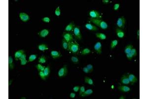 Immunofluorescence staining of Hela cells with ABIN7172014 at 1:100, counter-stained with DAPI. (TXN antibody  (AA 2-105))