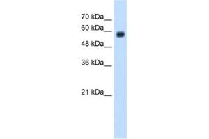 Western Blotting (WB) image for anti-C-Type Lectin Domain Family 4, Member M (CLEC4M) antibody (ABIN2462578) (C-Type Lectin Domain Family 4, Member M (CLEC4M) antibody)