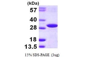 SDS-PAGE (SDS) image for DCN1, Defective in Cullin Neddylation 1, Domain Containing 2 (DCUN1D2) (AA 1-259) protein (His tag) (ABIN667515)