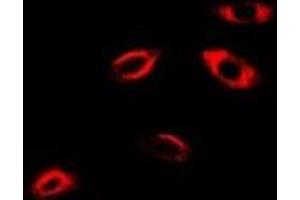 Immunofluorescent analysis of APRT staining in A549 cells. (APRT antibody)