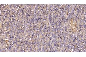 Detection of INSR in Human Pancreas Tissue using Monoclonal Antibody to Insulin Receptor (INSR) (Insulin Receptor antibody)