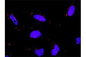 Proximity Ligation Analysis of protein-protein interactions between HSPA1L and TP53. (HSPA1L antibody  (AA 1-641))