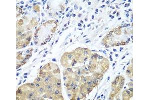 Immunohistochemistry of paraffin-embedded Human stomach using PLCB2 Polyclonal Antibody at dilution of 1:100 (40x lens). (Phospholipase C beta 2 antibody)