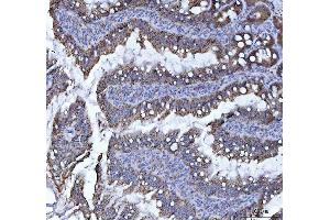 IHC analysis of LI Cadherin/CDH17 using anti-LI Cadherin/CDH17 antibody (ABIN7600855).