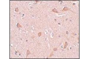 Immunohistochemistry of SIPA1L1 in human brain tissue with this product at 5 μg/ml. (SIPA1L1 antibody  (N-Term))