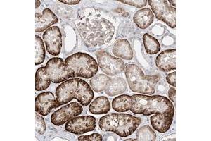 Immunohistochemical staining of human kidney with ABLIM2 polyclonal antibody  shows strong cytoplasmic positivity in cells of tubules. (ABLIM2 antibody)