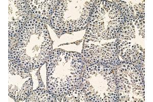 ABIN7095364 and ABIN7099421 at 1/100 staining mouse testis tissue by IHC-P. (WDR76 antibody)