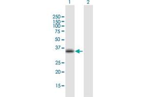Western Blot analysis of CCR5 expression in transfected 293T cell line by CCR5 MaxPab polyclonal antibody. (CCR5 antibody  (AA 1-352))