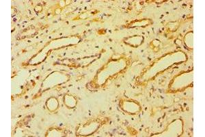 Immunohistochemistry of paraffin-embedded human kidney tissue using ABIN7145262 at dilution of 1:100 (BSND antibody  (AA 54-320))