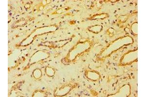 Immunohistochemistry of paraffin-embedded human kidney tissue using ABIN7145262 at dilution of 1:100 (BSND antibody  (AA 54-320))