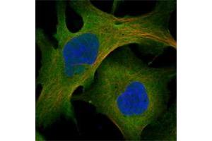Immunofluorescent staining of human cell line U-2 OS shows positivity in nucleoli, plasma membrane & cytoplasm. (Myosin X antibody)