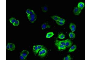 Immunofluorescent analysis of MCF-7 cells using ABIN7151372 at dilution of 1:100 and Alexa Fluor 488-congugated AffiniPure Goat Anti-Rabbit IgG(H+L) (ENTPD3 antibody  (AA 60-338))