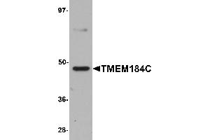 Western Blotting (WB) image for anti-Transmembrane Protein 184C (TMEM184C) (C-Term) antibody (ABIN1030749) (TMEM184C antibody  (C-Term))
