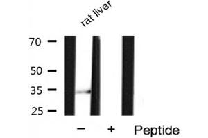 Western blot analysis of extracts of Rat liver lysates,using Phospho-Cyclin D1 (Ser90) Antibody . (Cyclin D1 antibody  (pSer90))