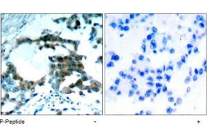Image no. 1 for anti-Protein Kinase C, theta (PRKCQ) (pSer695) antibody (ABIN196902) (PKC theta antibody  (pSer695))