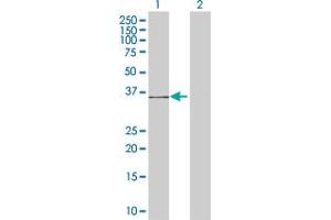 Western Blot analysis of CCBP2 expression in transfected 293T cell line by CCBP2 MaxPab polyclonal antibody. (CCBP2 antibody  (AA 1-384))