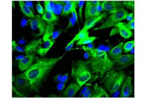 Immunofluorescence (IF) image for anti-Adaptor-Related Protein Complex 2, beta 1 Subunit (AP2B1) (AA 75-245) antibody (ABIN967931) (AP2B1 antibody  (AA 75-245))