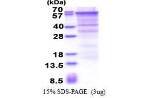 SDS-PAGE (SDS) image for Endoglin (ENG) (AA 26-586) protein (His tag) (ABIN5777937)