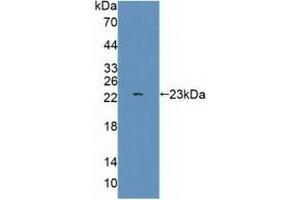 Figure. (Glutamate Receptor 3 antibody  (AA 649-823))