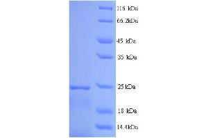SDS-PAGE (SDS) image for Interferon, alpha 14 (IFNa14) (AA 24-189) protein (His tag) (ABIN5713530)