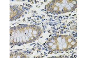 Immunohistochemistry of paraffin-embedded Human colon using DDX20 Polyclonal Antibody at dilution of 1:100 (40x lens). (DDX20 antibody)