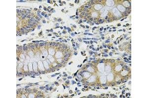 Immunohistochemistry of paraffin-embedded Human colon using DDX20 Polyclonal Antibody at dilution of 1:100 (40x lens).