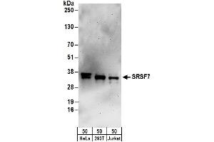 Western Blotting (WB) image for anti-Splicing Factor, Arginine/Serine Rich 7 (SFRS7) (AA 188-238) antibody (ABIN7454960)