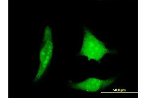 Immunofluorescence of monoclonal antibody to RCAN1 on HeLa cell. (RCAN1 antibody  (AA 1-100))