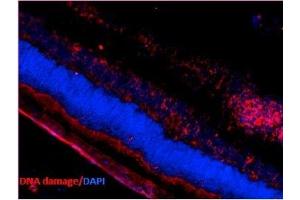 Immunohistochemistry analysis using Mouse Anti-DNA Damage Monoclonal Antibody, Clone 15A3 (ABIN361743 and ABIN361744). (DNA Damage antibody)