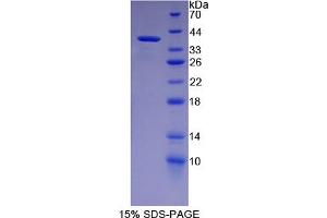 Image no. 1 for phospholipid Scramblase 1 (PLSCR1) (AA 1-318) protein (His tag) (ABIN4988860)
