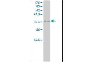 PRKRA antibody