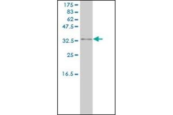 PRKRA antibody