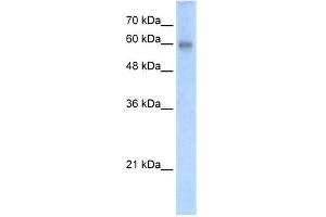 WB Suggested Anti-RCOR2 Antibody Titration:  5. (Rcor2 antibody  (N-Term))