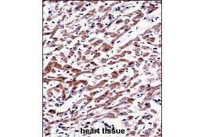 Immunohistochemistry (Formalin/PFA-fixed paraffin-embedded sections) of human heart tissue with MOV10 polyclonal antibody  followed by peroxidase conjugation of the secondary antibody and DAB staining. (MOV10 antibody  (AA 260-288))