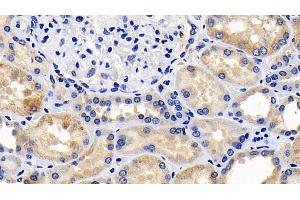 Detection of CASP9 in Human Kidney Tissue using Polyclonal Antibody to Caspase 9 (CASP9) (Caspase 9 antibody  (AA 331-416))