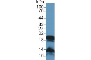 Detection of GKN2 in Rat Stomach lysate using Polyclonal Antibody to Gastrokine 2 (GKN2) (Gastrokine 2 antibody  (AA 21-184))