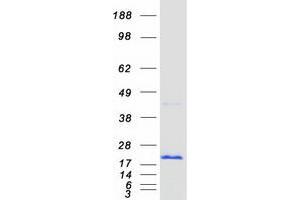 Validation with Western Blot (CNBP Protein (Transcript Variant 3) (Myc-DYKDDDDK Tag))