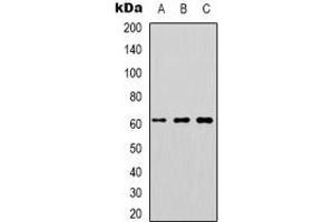 Western blot analysis of DOK1 expression in K562 (A), Jurkat (B), RAW264. (DOK1 antibody)