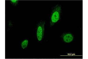 Immunofluorescence of monoclonal antibody to BIRC7 on HeLa cell. (BIRC7 antibody  (AA 1-90))