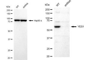 Western blotting analysis using YES1 antibody (ABIN7800809). (Recombinant YES1 antibody)