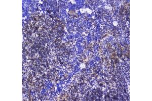 IHC testing of FFPE mouse spleen tissue with SHIP1 antibody at 1ug/ml.