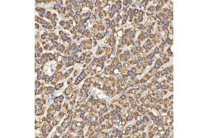 IHC analysis of Mitochondrial Dicarboxylate Carrier/SLC25A10 using anti-Mitochondrial Dicarboxylate Carrier/SLC25A10 antibody (ABIN7601497).