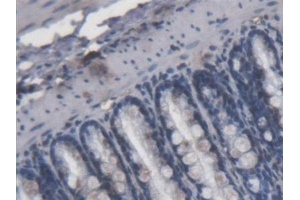 Lipopolysaccharides (LPS) antibody