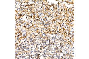Immunohistochemistry of paraffin-embedded human spleen using BST2 Rabbit pAb (ABIN6129547, ABIN6137673, ABIN6137675 and ABIN6215924) at dilution of 1:100 (40x lens). (BST2 antibody  (AA 49-161))