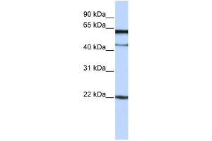 WB Suggested Anti-C6orf25 Antibody Titration:  0. (C6orf25 antibody  (N-Term))