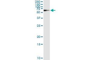 Immunoprecipitation of PGM1 transfected lysate using anti-PGM1 monoclonal antibody and Protein A Magnetic Bead , and immunoblotted with PGM1 MaxPab rabbit polyclonal antibody. (Phosphoglucomutase 1 antibody  (AA 1-562))