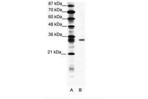 Image no. 1 for anti-Kv Channel Interacting Protein 4 (KCNIP4) (AA 27-76) antibody (ABIN202125) (KCNIP4 antibody  (AA 27-76))